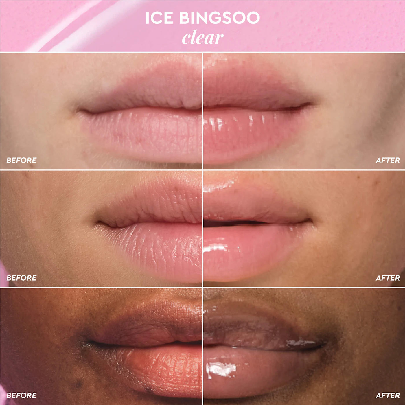 Glass Balm Lip Treatment - Ice Bingsoo