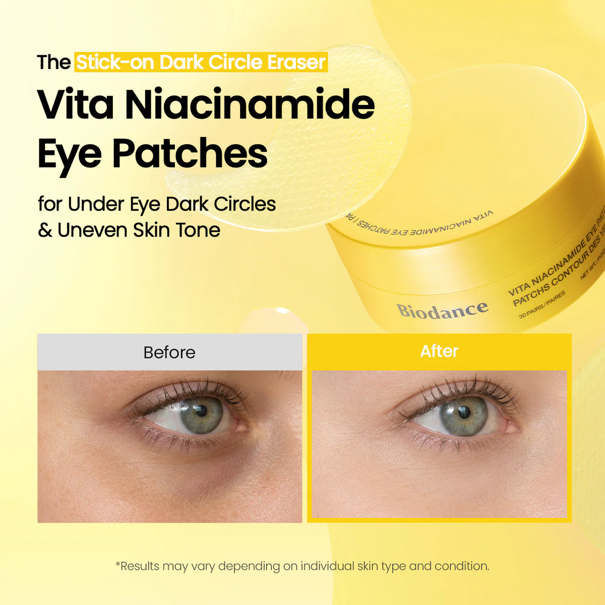 Vita Niacinamide Eye Patches