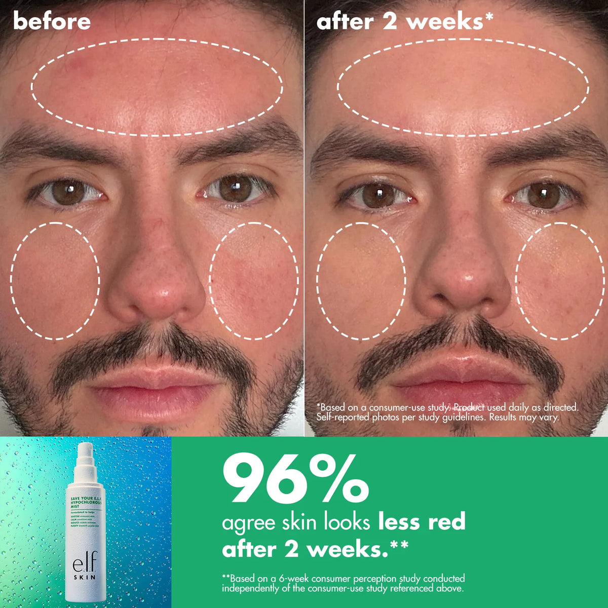 Save Your E.L.F. Hypochlorous Mist