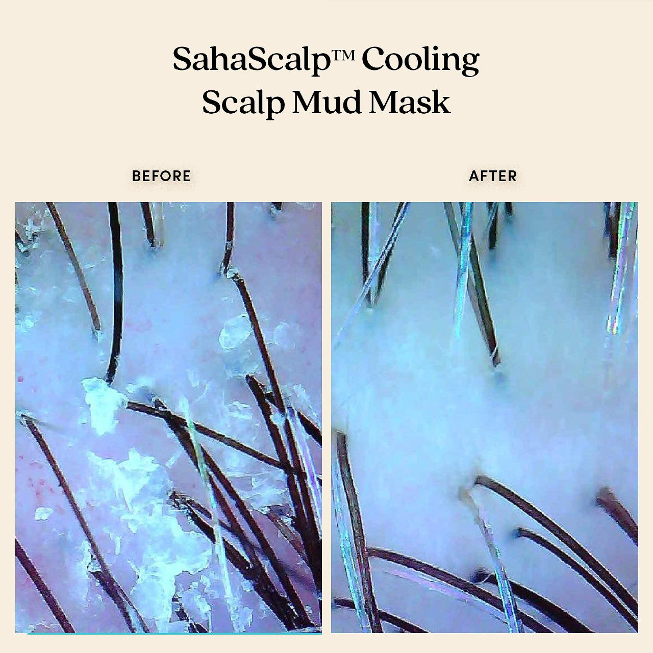 SahaScalp™ Cooling Scalp Mud Mask