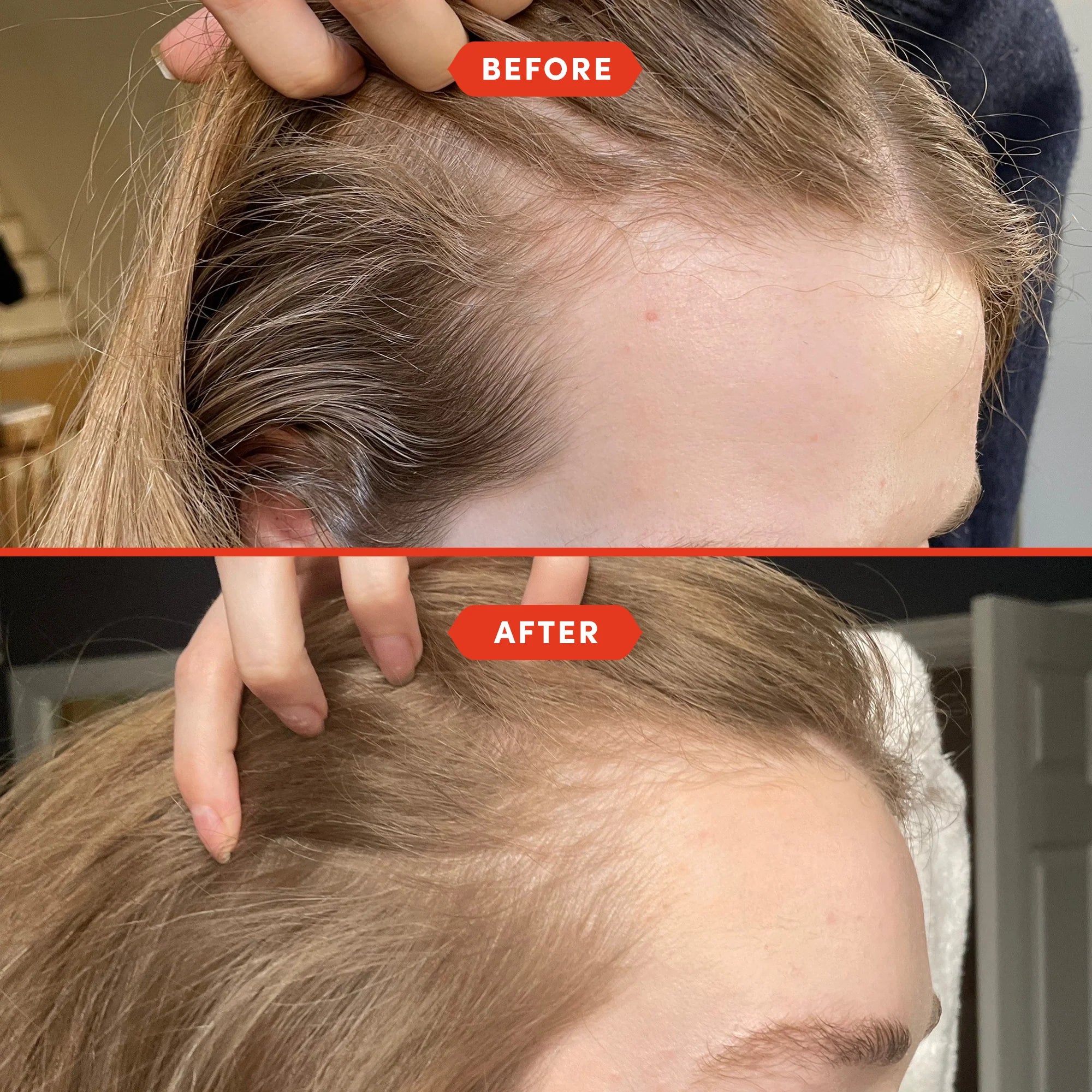 Strength & Shine Mini Hair Oiling Duo