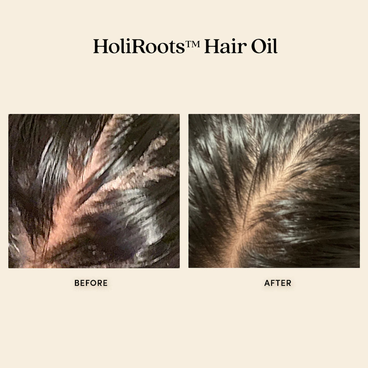 HoliRoots™ Hair Oil Mini
