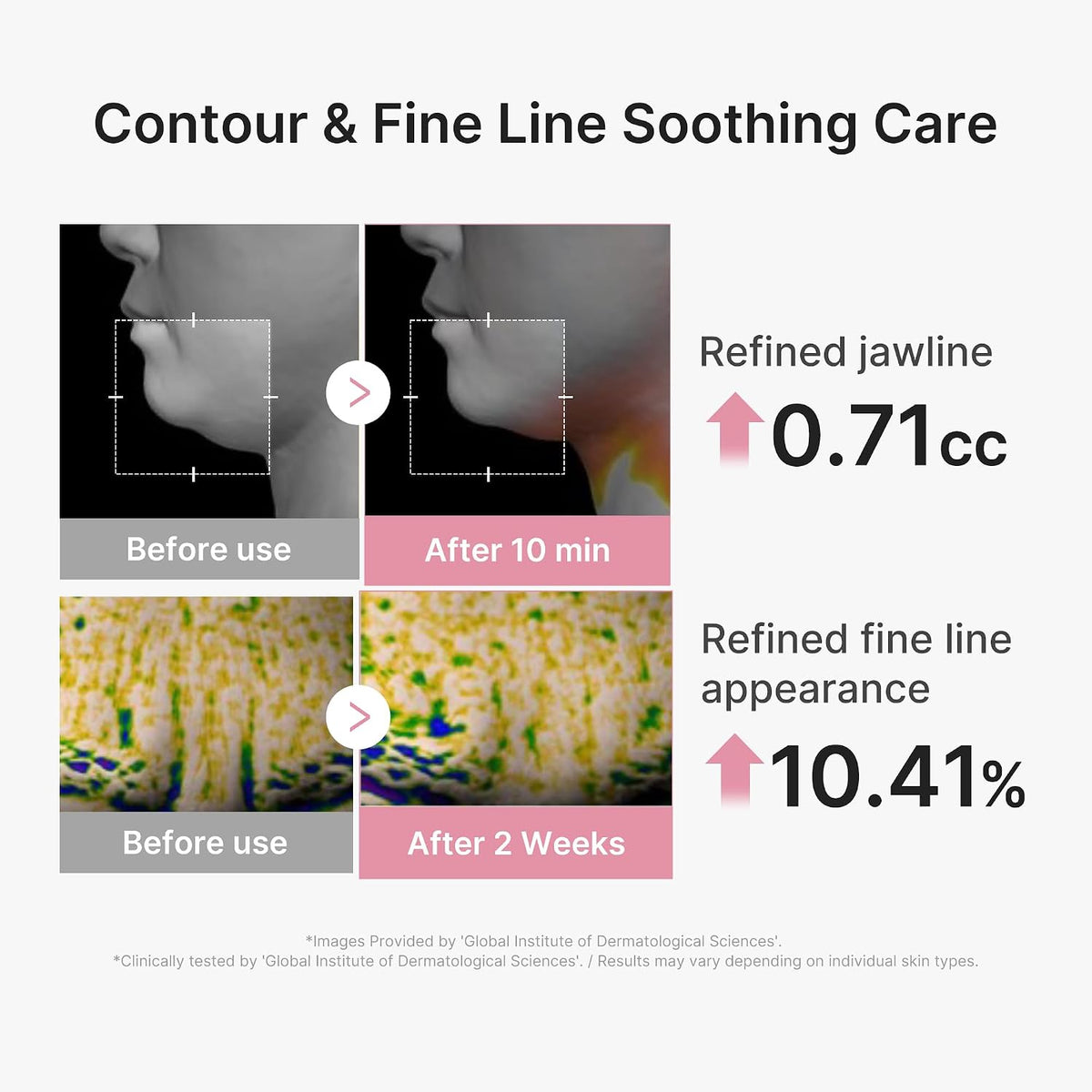 PDRN Pink Tension Up Sheet Mask