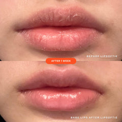 LipSoftie™ Lip Treatment SOS Vanilla