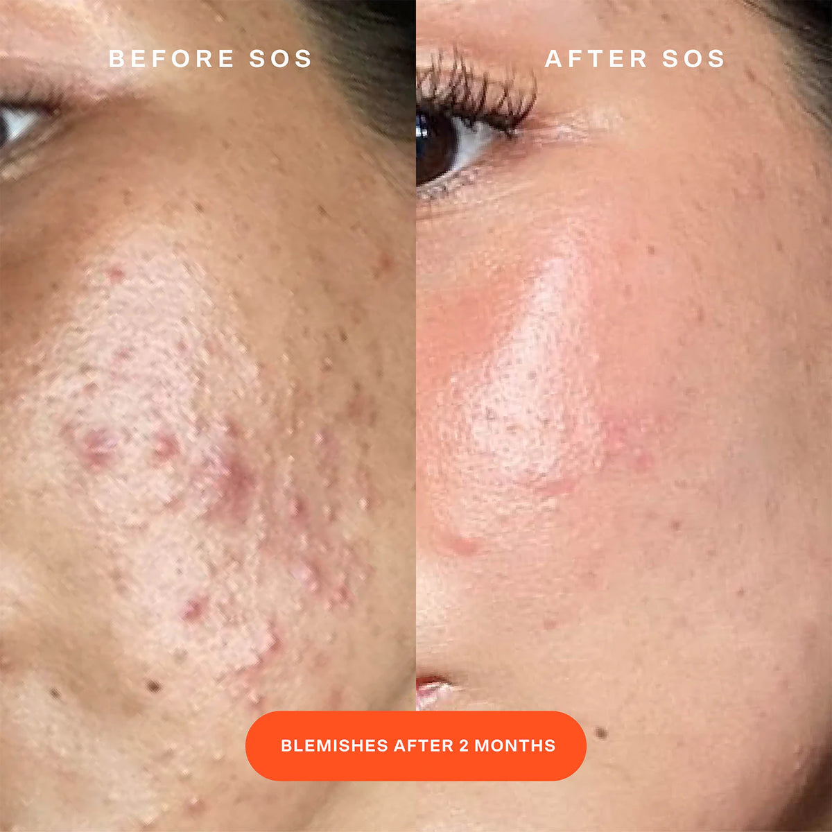 SOS Daily Rescue Facial Spray - Travel Size