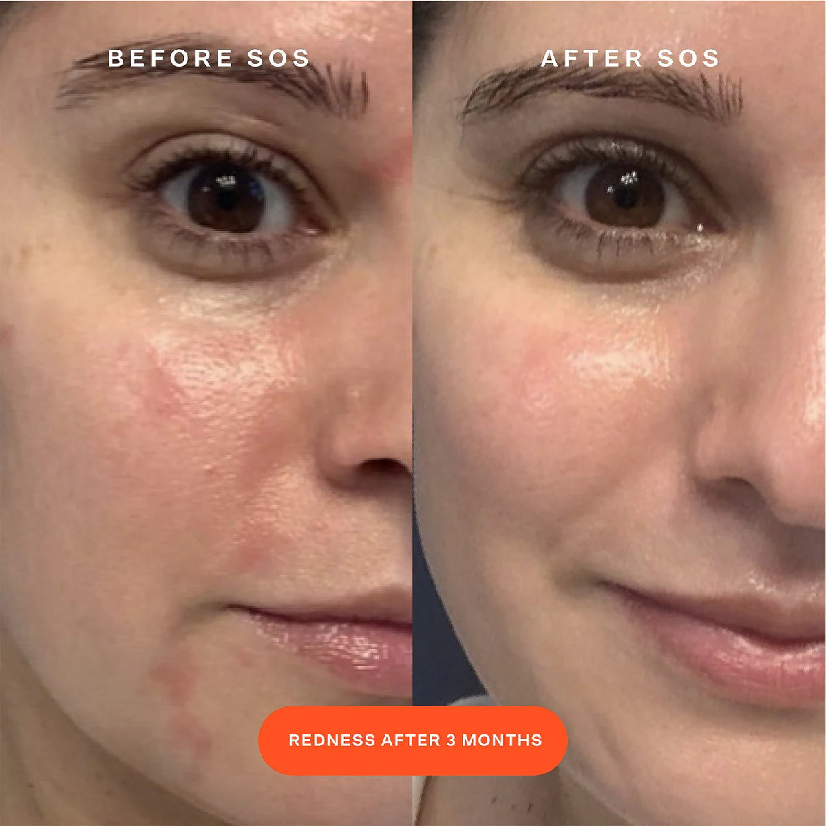 SOS Daily Rescue Facial Spray - Travel Size